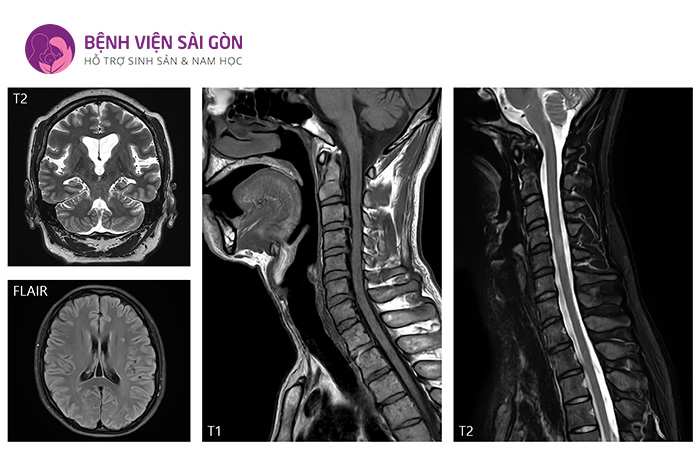 X-quang và MRI